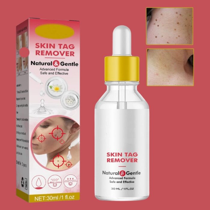 Super Luxe Skin Tag Remover