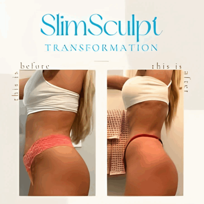 SlimSculpt MD