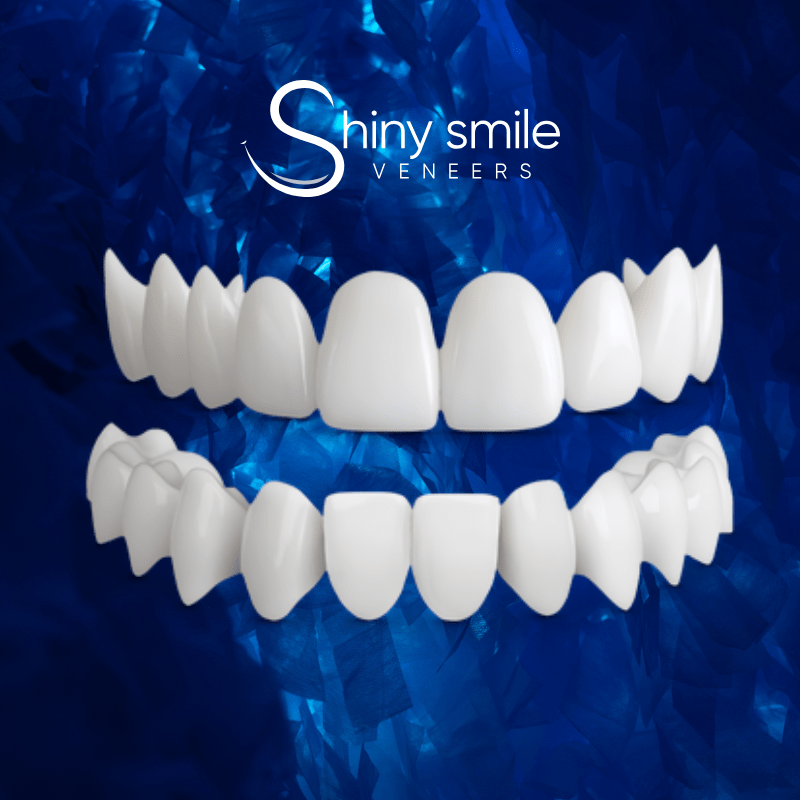 Shiny Smile Veneers