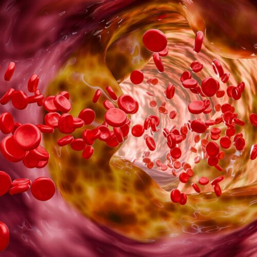 Arterial Flush Ritual